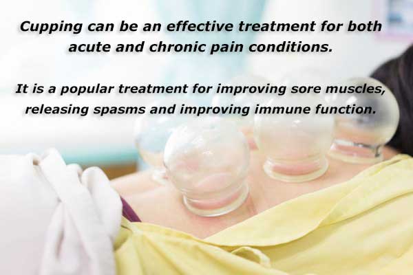 An image of cups placed on a person's back to provide cupping physical therapy